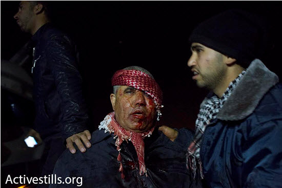 A man bleeds from his head wound incurred during clashes between Arab-Bedouin and police in the city of Rahat, January 18, 2015.