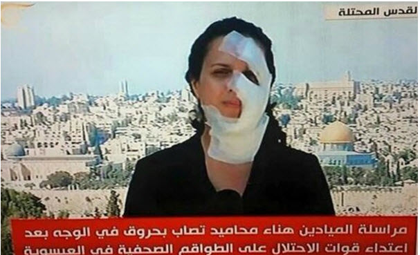 Video footage: Hana Mahameed returned to reporting for the Lebanon-based Mayadeen TV with bandages covering the parts of her face burned by a stun grenade.