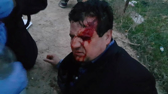 MK Ayman Odeh on the ground after having been injured in the clashes at Umm al-Hiran