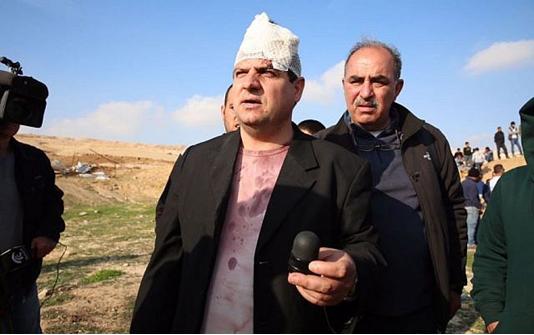 Joint List leader MK Ayman Odeh (Hadash) was wounded during the protest against house demolitions in the unrecognized Bedouin village of Umm al-Hiran in the Negev on January 18, 2017. Here Odeh is holding the sponge-tipped bullet that injured him.