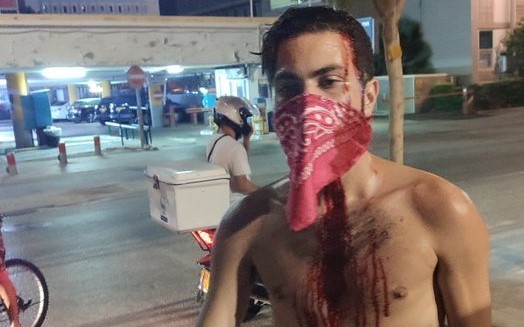 One of the protestors attacked by fascists as he and hundreds of others demonstrated in Tel Aviv late Tuesday evening, July 28, against PM Netanyahu, Public Security Minister Amir Ohana, and police brutality