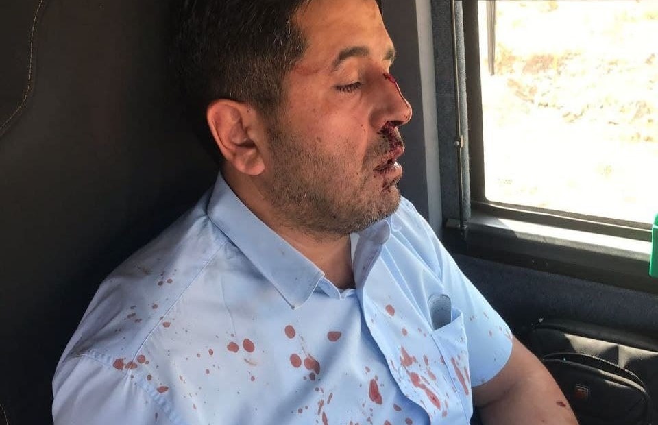 Palestinian bus driver Muhammad al-Qaq, 47, was assaulted near the occupied West Bank settlement of Shvut Rachel by a 21-year-old Israeli settler who refused to wear a face mask in the sealed bus, August 13, 2021. 