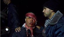 A man bleeds from his head wound incurred during clashes between Arab-Bedouin and police in the city of Rahat, January 18, 2015.