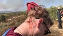 An Israeli activist who was attacked by settlers in the Palestinian village of Burin in the northern West Bank, October 16, 2019
