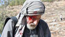 Rabbi Arik Ascherman after the attack by Israeli settlers near the West Bank settlement of Bat Ayin on Friday, November 12, 2021